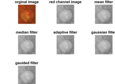 Figure 2. Different filters applied in glaucoma image show: the original image, mean, median, adaptive, Gaussian and guided filters.