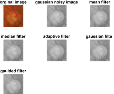 Table 2. Performance evaluation of retinal image using spatial filters. 