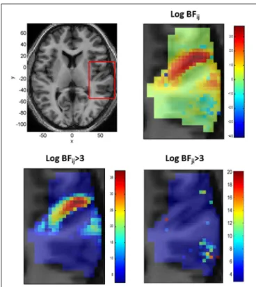 FIGURE 9 | Top Left: Axial slice of structural image at z = 6 with bounding box showing region displayed on other three panels (x, y, and z denote MNI coordinates in mm), Top Right: Log Bayes factor for Gaussian versus Mexican-Hat NRFs (full range of value
