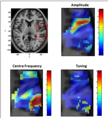 FIGURE 5 | Tonotopic Mapping with Gaussian neural response functions. Top Left: Axial slice of structural image at z = 6 with bounding box showing region displayed on other three panels (x, y, and z denote MNI coordinates in mm)