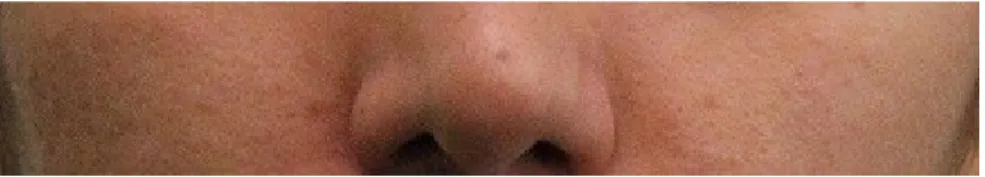 Figure  ‎4-13   is  a  sample  of  the  individual  skin  and  Figure  ‎4-14   is  the  histogram  of  R  component of the RGB image
