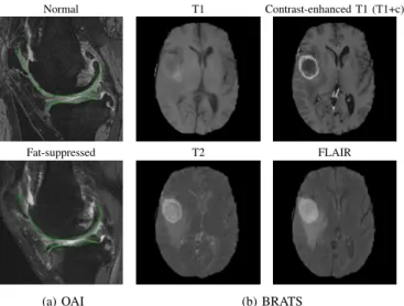 Fig. 4. Example scans from OAI and BRATS, showing the two knee MRI modalities and four brain MRI modalities.