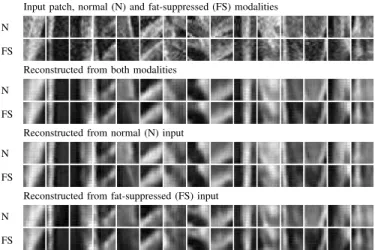 Fig. 5. Original input and reconstructions for 15 patches from the OAI dataset, showing the center slice from each 3D patch