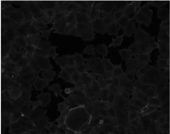 Figure 4.4: Actin channel image for DNA damage MOA when the compound is mitomycin C and concentration is 0.3 in week 4 [10].