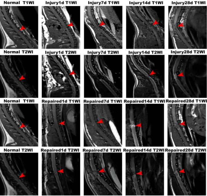 Figure 2: MRI imaging of Normal group, Injury group and Repaired group in the rat SCI model at 1 d, 7 d, 14 d and  28 d