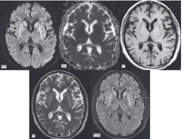 Figure 8: Magnetic resonance imaging findings on day 36. T2‑weighted sagittal and coronal sections (as labeled) at the level of pons