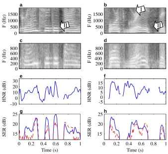 Figure 7: The source parameters of the autoregressive (AR) and harmonic-and-noisy (HN) modelswere estimated from Q = 2 convolutive mixtures using the EM algorithm