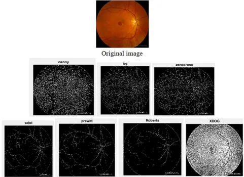 Figure 14. Edge detection for original image and classical methods 240x960 