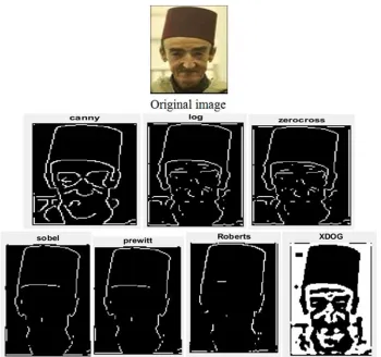 Figure 17. Edge detection for original image and classical methods 337x1356. 