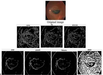 Figure 18. Edge detection for original image and classical methods 201x750. 