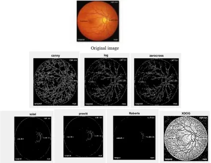 Figure 12. edge detection for original image and classical methods 241x627. 