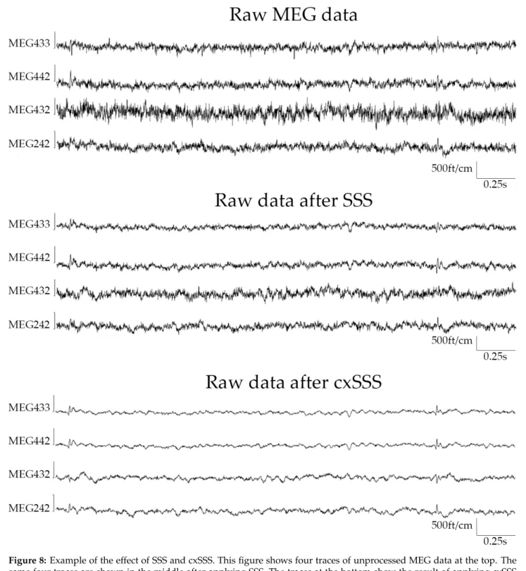 Figure 8: Example of the effect of SSS and cxSSS. This figure shows four traces of unprocessed MEG data at the top