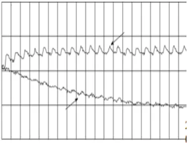 Fig 7:Automated irrigation triggered by the soil moisture threshold < 5% 