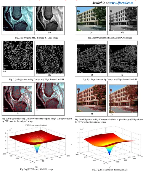 Fig. 3(g)PST Kernel of  building image(g)  