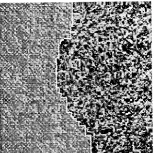 Figure 2: Image // and the segmentationboundary shown in (a).I.-esults at two clifferent levels' Estimatecl