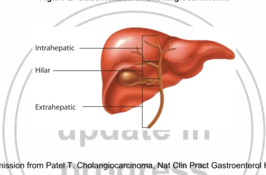 Figure 1: Classification of Cholangiocarcinoma 