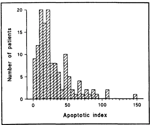 Fig. S.2 FrequeDcy distribudoD of apoptodc indices of tbe artblval IUDg tumoun. 