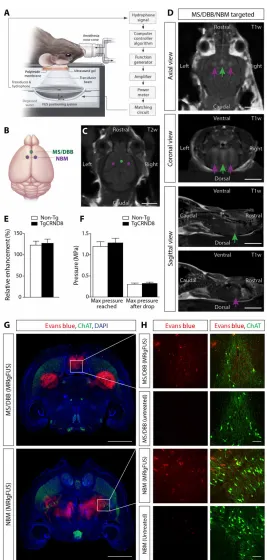 Fig. 2. Noninvasive FUS-induced BBB permeability localized to the basal forebrain under MRI guidance