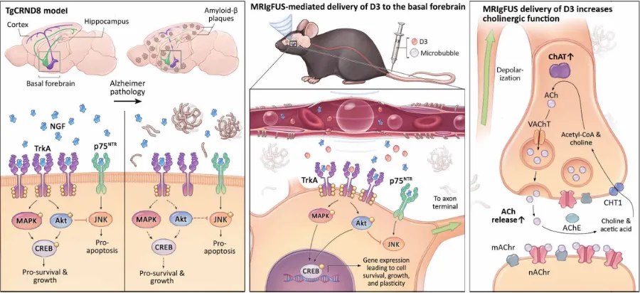 Fig. 5. MRIgFUS delivery of D3 enhances cholinergic function 3 days after treatment. (non-Tg littermates in the (A) MS/DBB and (B) NBM