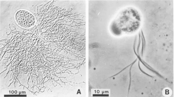 FIG. 1. (A) Light micrograph of rumen anaerobic fungus. Thallus showing sporangium and highly branched rhizoid