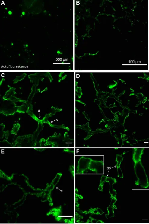 Fig. 2. Confocal laser scanning fluorescence microscopy using WGA-FITC of mycelium-like structure illustrated in Fig