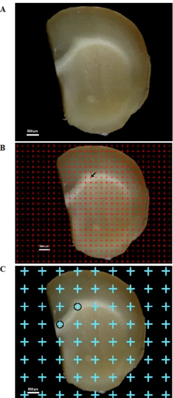 Figure 6:  (A) One of the successive 1-mm-thick cerebral sections. Bar = 500 μm. (B) A point grid was randomly placed on one of the 