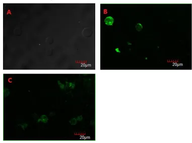 Figure 1 The green fluorescence under confocal microscope Note: (A) Jurkat cells with no luminescence; (B) Jurkat cells transfected with LAT-EGFP; (C) Jurkat cells transfected with LAT-M-EGFP