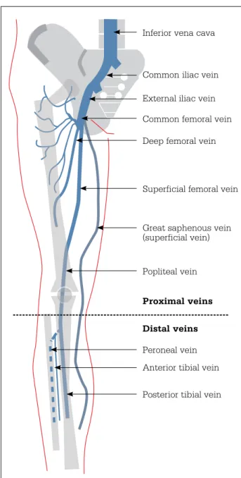 Table 1. Clinical risk factors for venous  thromboembolism 5