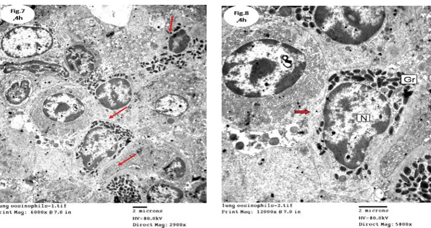 Figure 8. TEM of rabbit lung collected at 4 hours post-exposure showing breakdown of eosinophil membranes
