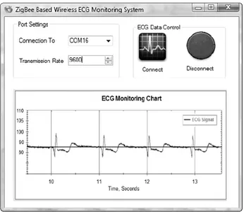 Fig. 6. Display screen of ECG data transmission software 