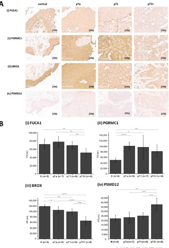 Figure  2:  Verification  of  proteomics  findings  using  immunohistochemistry.  (A) Stained sections and (B)  quantification  results for (i) FUCA 1, (ii) PGRMC1 (iii) BROX and (iv) PSMD12 from control, pTa, pT1 and pT2+ human samples are presented