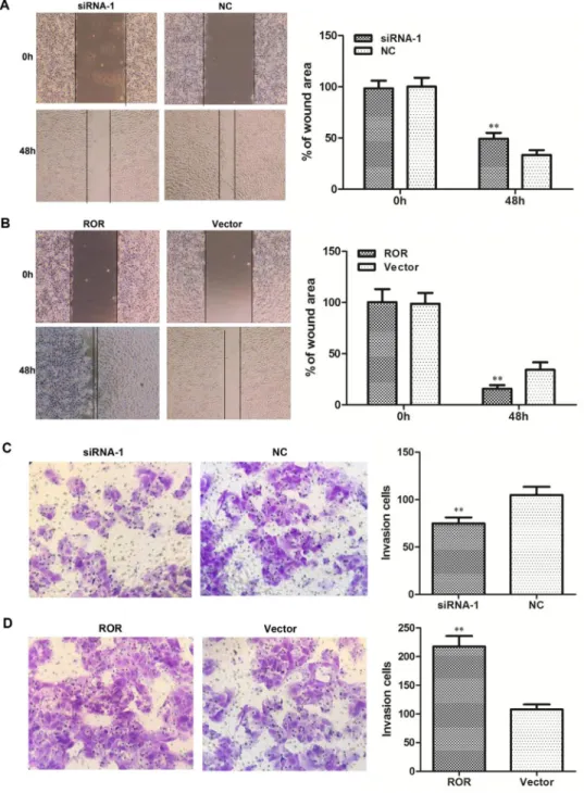 Figure 3: Effects of linc-ROR on the migration and invasion of SKOV3 cells.  Linc-ROR promoted the migratory and invasive  abilities of ovarian cancer cells