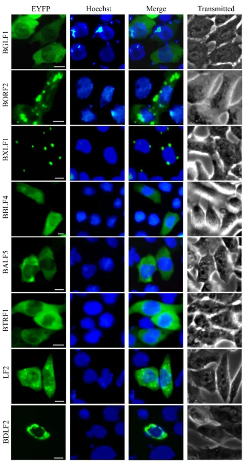 Figure 2: Cytoplasmic localization summary of EBV-encoded proteins.  32 EYFP-fused EBV-encoded proteins were expressed  in COS-7 cells, and cells were subjected to fluorescence microscope analysis in live cells 24 h after transfection