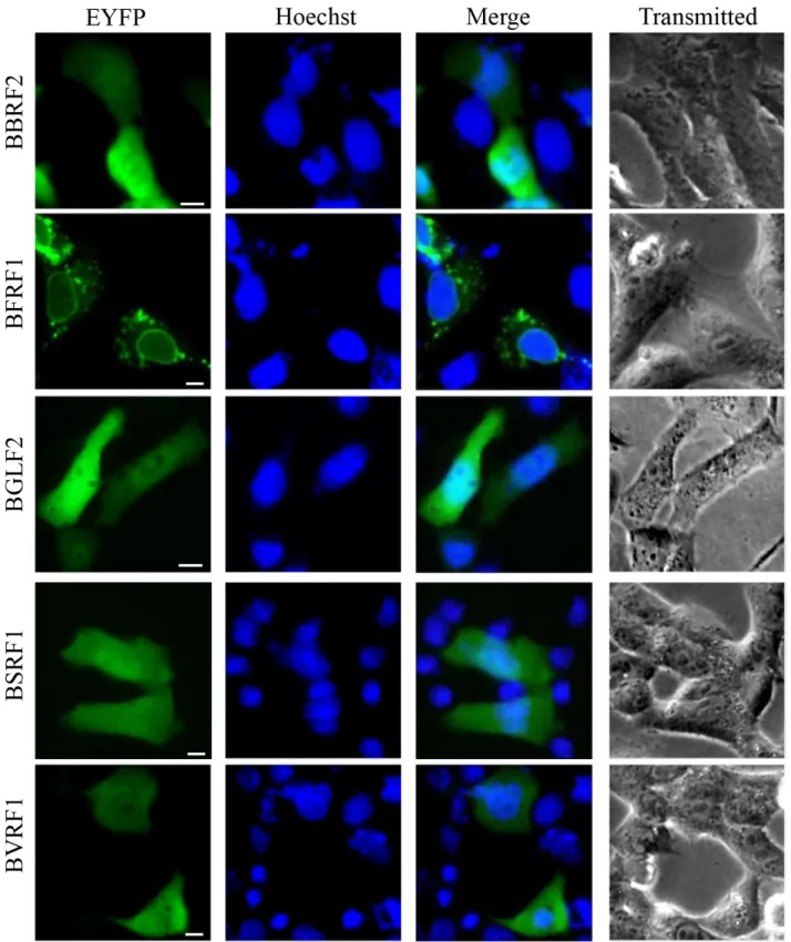 Figure 3: Pan-cellular localization summary of EBV-encoded proteins.  21 EYFP-fused EBV proteins were expressed in COS-7 