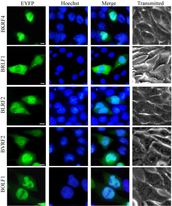 Figure 1: Nuclear localization summary of EBV-encoded proteins.  28 EYFP-fused EBV proteins were expressed in COS-7  cells, and cells were subjected to fluorescence microscope analysis in live cells 24 h after transfection