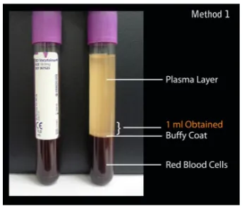 Table 3:  Data analysed on the number of folds comparing whole blood with PRP. 