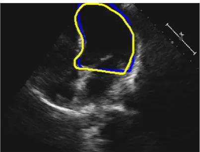 Fig. 1. An example 2D 4-chamber view. The blue and yellow curves represent the annotations by Operator-A and Operator-B, respectively