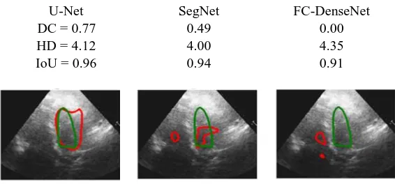 Fig. 4. Failed case example outputs from U-Net, SegNet, and FC-DenseNet models.