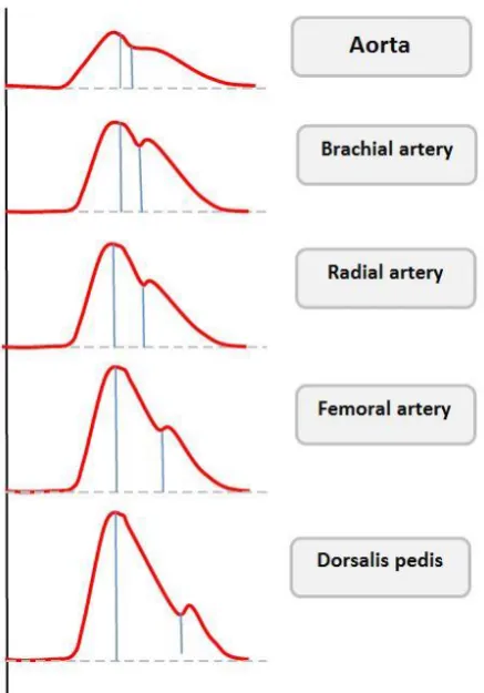fig:1 variations in arterial wave contour from central to peripheral arteries 