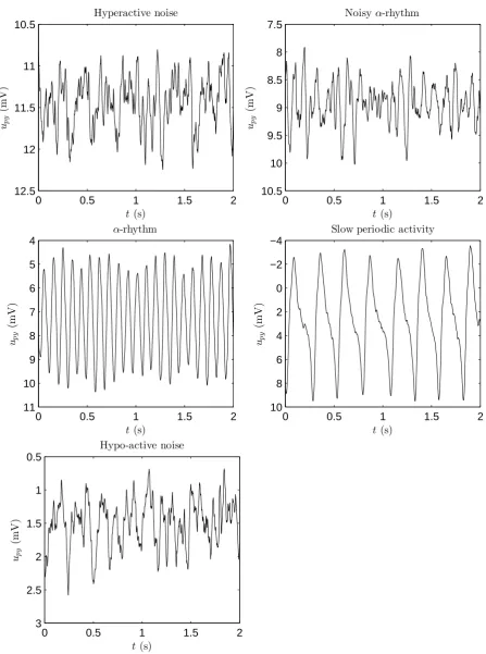 Figure 2.6: Time series for diﬀerent activity types seen by Jansen and Rit [17] in their model.Top: hyperactive noise and noisy α-rhythm.Middle: α-rhythm and slow periodic activity.Bottom:hypo-active noise