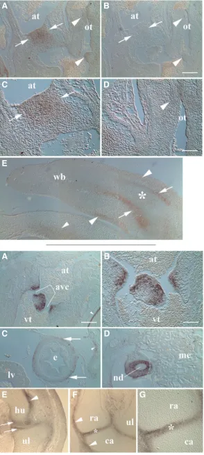 Fig. 3. MXRA5 mRNA expression in developing heart and limb at HH28. (A) Mesenchyme of fused atrioventricular cush-ions showed expression (arrows) particularly toward the atrial (at) aspect