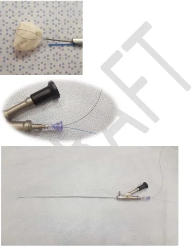 Fig. 1. Instrument setup. A four-wire Nitinol stone basket and laser fiber are passed through a single-channel, semi-rigid ureteroscope