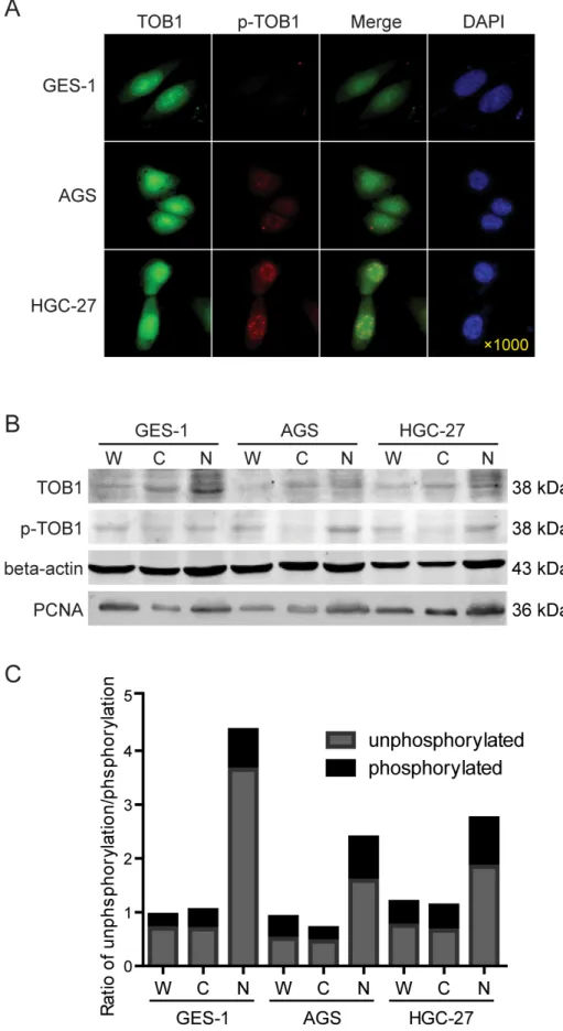 Figure 3: The subcellular distribution of TOB1 and p-TOB1 protein in AGS and HGC-27 GC cells