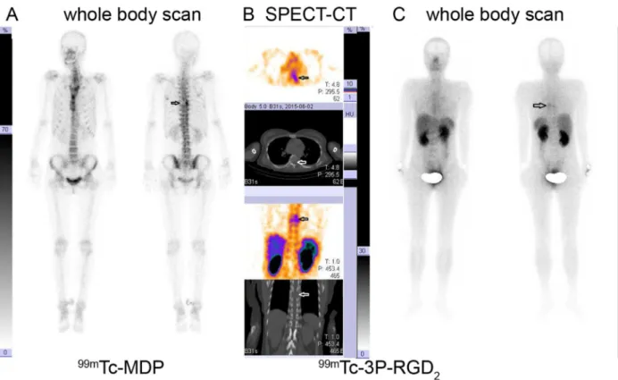 Table 2: Comparative analysis of  99m Tc-3P-RGD