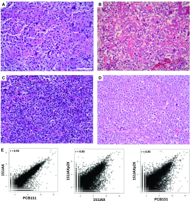 Figure 3: Development and validation of PCB151JAX osteosarcoma culture. H&amp;E images: (A) Biopsy specimen from  patient
