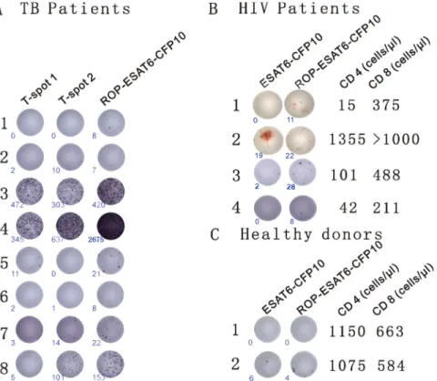Figure 3: ROPs for the diagnosis of TB.  (A) Detection of TB with ROP antigens is comparable to current diagnostic tests