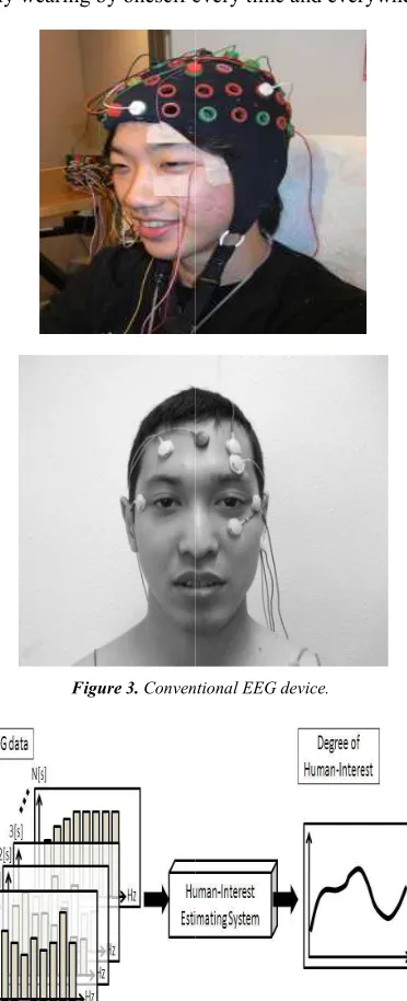 Figure 3. Conventional EEG device. Conventional EEG device