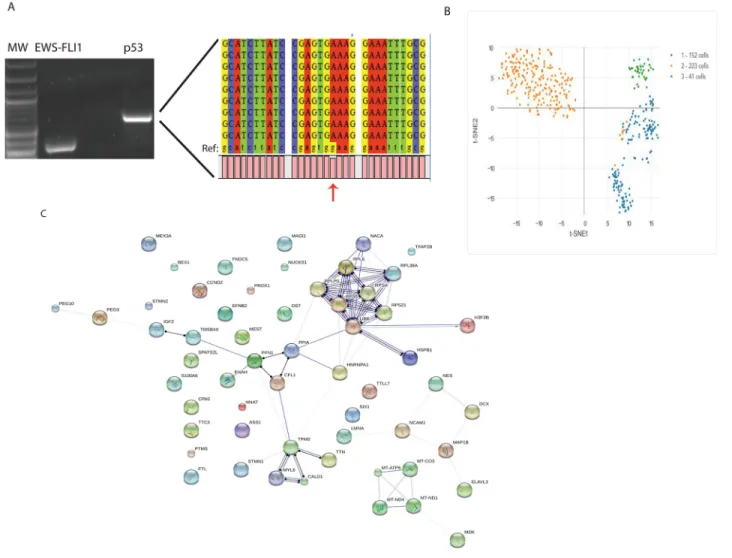 Figure 5: Molecular analysis of CTC from a Ewing sarcoma patient.  (A) RNA was extracted from CTC isolated from the blood  of a patient with localized Ewing sarcoma of the thigh and amplified with primers specific for the EWS-FLI1 translocation (Lane 2) or