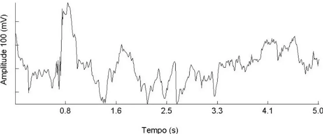 Figure 13. Electro-encephalic signal of bovine.  (Sinal elétrico cerebral de bovino).