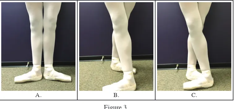 Figure 3. Foot and ankle placements requiring turn out of the hip. 